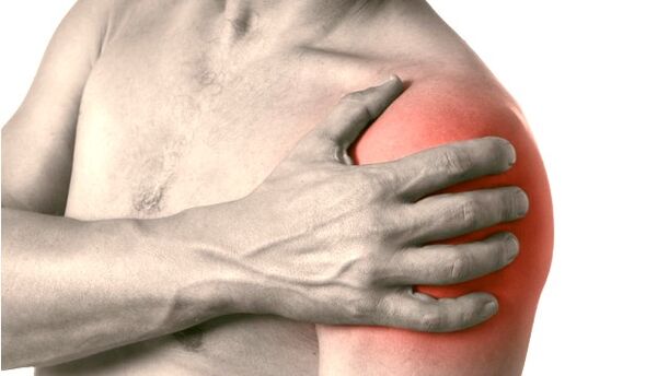 Une épaule enflée, rouge et hypertrophiée - symptômes d'arthrose de l'articulation de l'épaule de grade 2-3