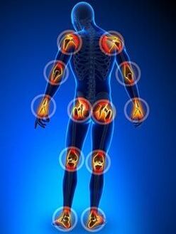 Localisation des articulations affectées par l'arthrose