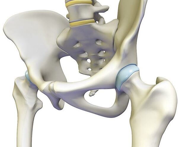 L'ostéochondrose provoque une douleur aiguë dans l'articulation de la hanche